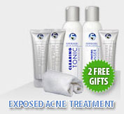 top acne products exposed graphic image